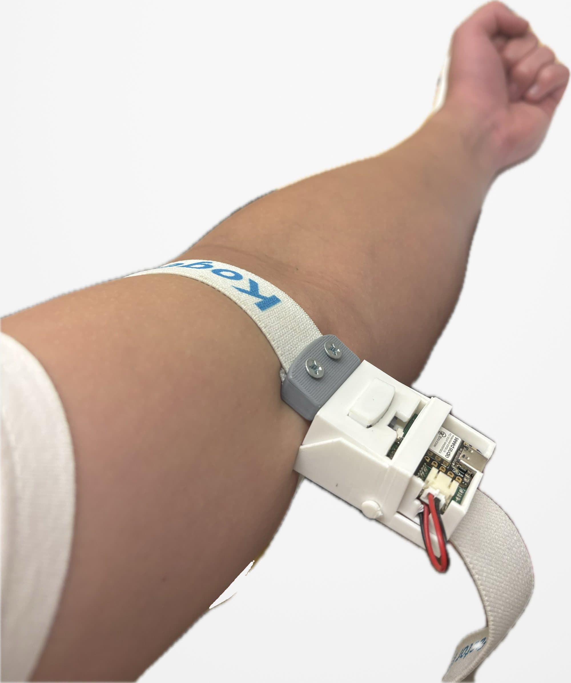 The Infusinator smart tourniquet (Prototype 1) strapped on an arm